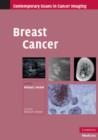 Breast Cancer - Book