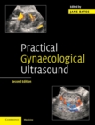 Practical Gynaecological Ultrasound - Book