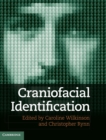 Craniofacial Identification - Book