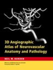 3D Angiographic Atlas of Neurovascular Anatomy and Pathology - Book