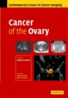 Cancer of the Ovary - Book