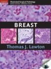 Breast - Book