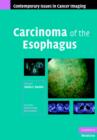 Carcinoma of the Esophagus - Book