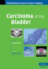 Carcinoma of the Bladder - Book