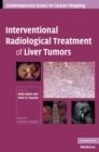 Interventional Radiological Treatment of Liver Tumors - Book