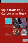 Squamous Cell Cancer of the Neck - Book