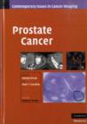 Prostate Cancer - Book