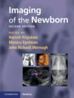 Imaging of the Newborn - Book