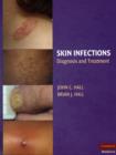 Skin Infections : Diagnosis and Treatment - Book