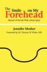 The Smile on My Forehead: Memoir of My Life With a Brain Injury - Book