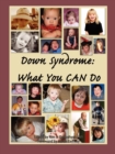Down Syndrome: What You CAN Do - Book