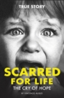 Scarred for Life : The Cry Of Hope - Book