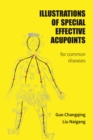 Illustrations Of Special Effective Acupoints for common Diseases - eBook