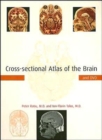 Cross-sectional Atlas of the Brain and DVD - Book