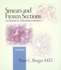 Smears and Frozen Sections in Surgical Neuropathology : A Manual - Book