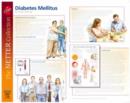 Frank H. Netter Diabetes and Complications Poster - Book