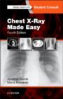 Chest X-Ray Made Easy - Book