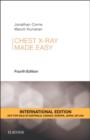 Chest X-Ray Made Easy - Book