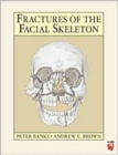 Fractures of the Facial Skeleton - Book
