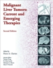 Malignant Liver Tumors : Current and Emerging Therapies - Book