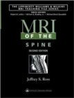 MRI of the Spine - Book