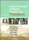 Computed Tomography and Magnetic Resonance of the Thorax - Book