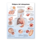 Dangers of Smoking Anatomical Chart in Spanish (Peligros Del Tabaquismo) - Book