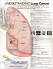 Understanding Lung Cancer Anatomical Chart - Book
