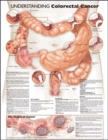 Understanding Colorectal Cancer Anatomical Chart - Book