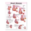 Heart Disease Anatomical Chart - Book