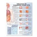 Sexually Transmitted Infections Anatomical Chart in Spanish (Infecciones de transmision sexual) - Book
