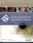 Eyelid, Conjunctival, and Orbital Tumors and Intraocular Tumors : An Atlas and Text (Two-Volume Set) - Book