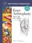 Master Techniques in Orthopaedic Surgery: Knee Arthroplasty - Book