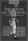 Amputations and Prosthetics - Book