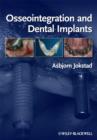 Osseointegration and Dental Implants - eBook