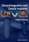 Osseointegration and Dental Implants - Book