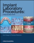 Implant Laboratory Procedures : A Step-by-Step Guide - eBook