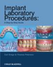 Implant Laboratory Procedures : A Step-by-Step Guide - Book