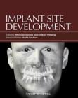 Implant Site Development - Book