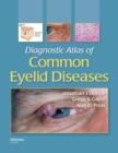 Diagnostic Atlas of Common Eyelid Diseases - Book