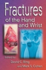 Fractures of the Hand and Wrist - Book