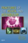 Fractures of the Pelvis and Acetabulum - Book