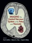 Imaging the Central Nervous System of the Fetus and Neonate - Book