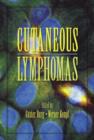 Cutaneous Lymphomas - Book