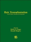 Hair Transplantation, Fourth Edition - Book