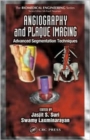 Angiography and Plaque Imaging : Advanced Segmentation Techniques - Book
