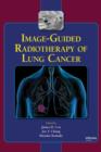 Image-Guided Radiotherapy of Lung Cancer - eBook