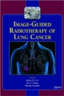 Image-Guided Radiotherapy of Lung Cancer - Book