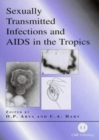 Sexually Transmitted Infections and AIDS in the Tropics - Book