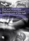 Oral and Intravenous Bisphosphonate-Induced Osteonecrosis of the Jaws : History, Etiology, Prevention, and Treatment, Second Edition - eBook